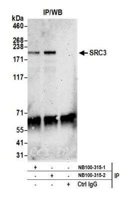Immunoprecipitation: NCOA3/AIB1 Antibody [NB100-315]