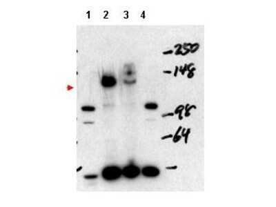 Western Blot: NCOA3/AIB1 Antibody [NBP1-77785]