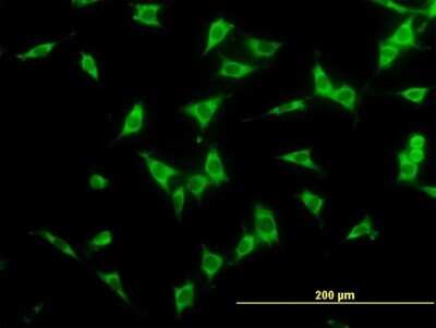 Immunocytochemistry/ Immunofluorescence: NCOA4 Antibody (1B7) [H00008031-M04]