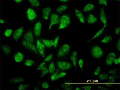 Immunocytochemistry/ Immunofluorescence: NCOA4 Antibody (1F11) [H00008031-M05]