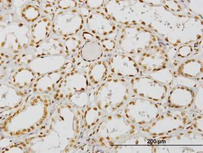 Immunohistochemistry-Paraffin: NCOA4 Antibody (1F11) [H00008031-M05]