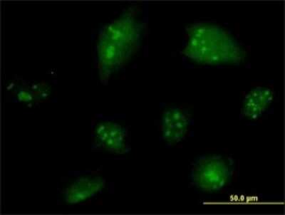 Immunocytochemistry/ Immunofluorescence: NCOA6 Antibody (2D7) [H00023054-M01]
