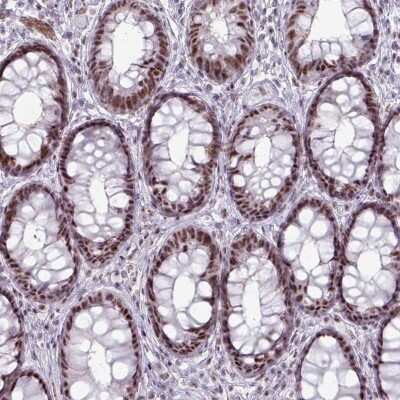 Immunohistochemistry: NCOR1 Antibody [NBP2-47360]