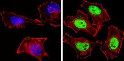 Immunocytochemistry/ Immunofluorescence: NCOR2 Antibody [NB120-5802]
