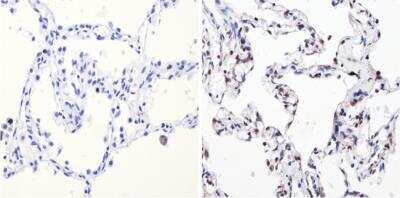 Immunohistochemistry: NCOR2 Antibody [NB120-5802]