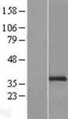 Western Blot: NKp46/NCR1 Overexpression Lysate [NBP2-09751]
