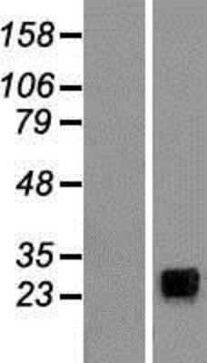 Western Blot: NKp30/NCR3 Overexpression Lysate [NBL1-13521]