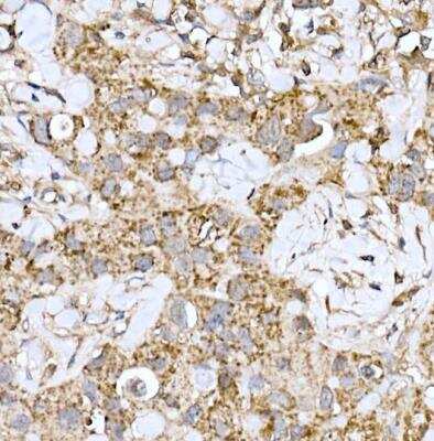 Immunohistochemistry-Paraffin: ND6 Antibody - Azide and BSA Free [NBP2-94464]