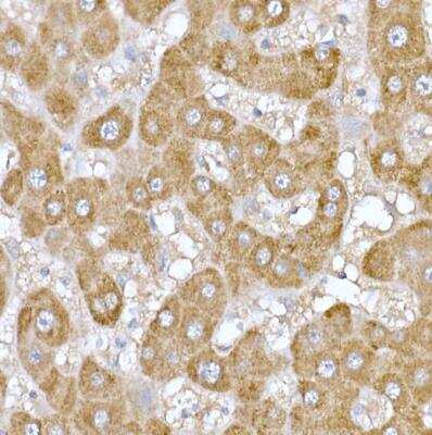 Immunohistochemistry-Paraffin: ND6 Antibody - Azide and BSA Free [NBP2-94464]