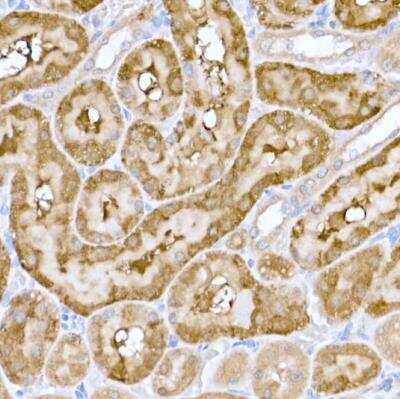 Immunohistochemistry-Paraffin: ND6 Antibody - Azide and BSA Free [NBP2-94464]