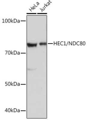 Western Blot: NDC80 Antibody (4W2Y2) [NBP3-16121]