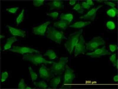 Immunocytochemistry/ Immunofluorescence: NDE1 Antibody (2G11-1C11) [H00054820-M01]