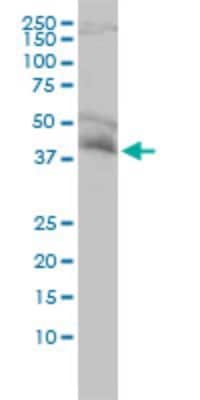 Western Blot: NDE1 Antibody (2G11-1C11) [H00054820-M01]