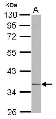 Western Blot: NDE1 Antibody [NBP2-19497]