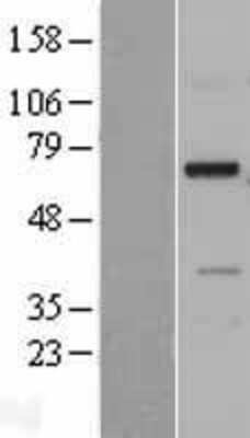 Western Blot: NDNF Overexpression Lysate [NBL1-08472]