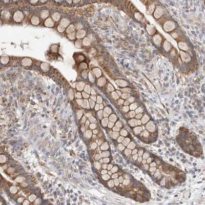 Immunohistochemistry-Paraffin: NDOR1 Antibody [NBP1-88790]