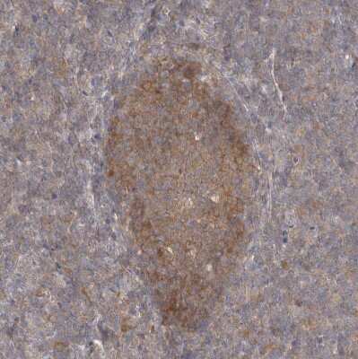 Immunohistochemistry-Paraffin: NDOR1 Antibody [NBP1-88790]