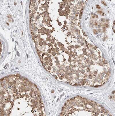 Immunohistochemistry-Paraffin: NDOR1 Antibody [NBP1-88790]