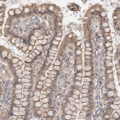 Immunohistochemistry-Paraffin: NDOR1 Antibody [NBP1-88790]