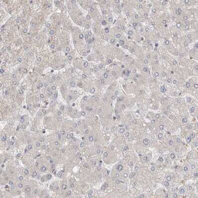 Immunohistochemistry-Paraffin: NDOR1 Antibody [NBP1-88790]