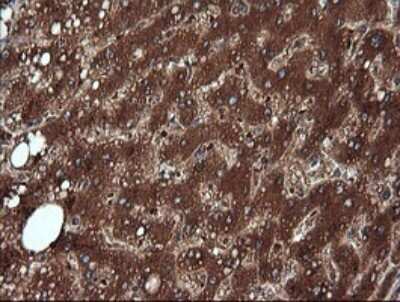 Immunohistochemistry: NDOR1 Antibody (OTI1E3) [NBP2-45856]