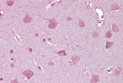 Immunohistochemistry-Paraffin: Norrin/NDP Antibody [NBP1-59305]