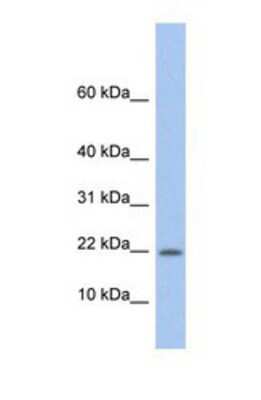 Western Blot: Norrin/NDP Antibody [NBP1-59305]