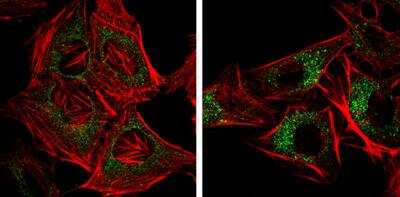 Immunocytochemistry/ Immunofluorescence: NDP52 Antibody (422) [NBP2-43696]
