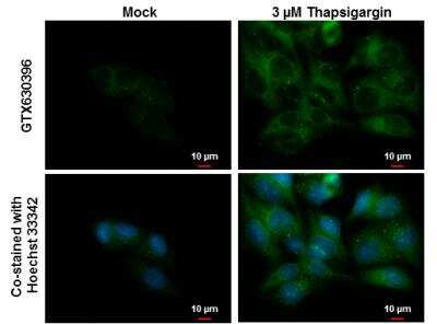 Immunocytochemistry/ Immunofluorescence: NDP52 Antibody (422) [NBP2-43696]