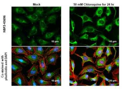 Immunocytochemistry/ Immunofluorescence: NDP52 Antibody (422) [NBP2-43696]