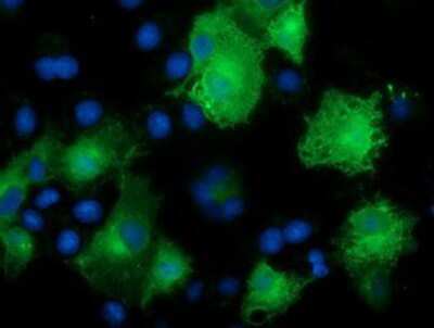 Immunocytochemistry/ Immunofluorescence: NDP52 Antibody (OTI4H5) [NBP2-03246]
