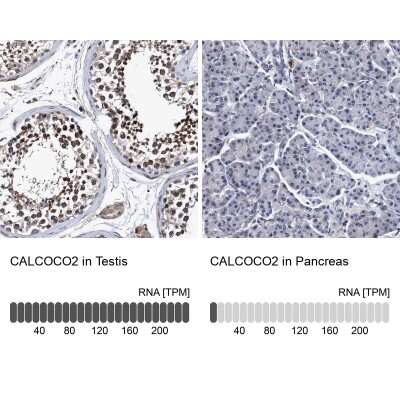 Immunohistochemistry-Paraffin: NDP52 Antibody [NBP1-87874]