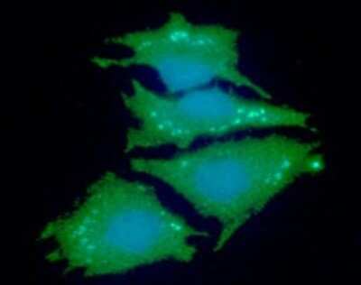 Immunocytochemistry/ Immunofluorescence: NDRG1 Antibody (11G4) - BSA Free [NBP2-59415]