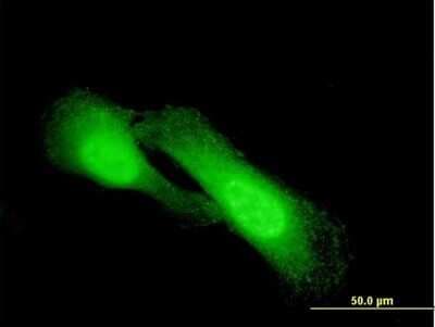 Immunocytochemistry/ Immunofluorescence: NDRG1 Antibody (2D7) [H00010397-M03]