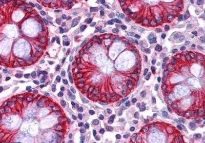 Immunohistochemistry-Paraffin: NDRG1 Antibody [NB300-839]