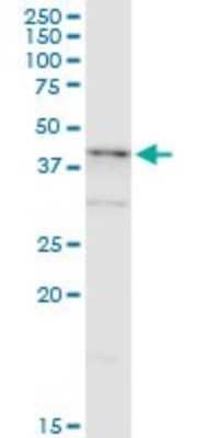 Western Blot: NDRG2 Antibody (6A5) [H00057447-M03]