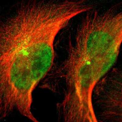 Immunocytochemistry/ Immunofluorescence: NDRG2 Antibody [NBP1-81424]