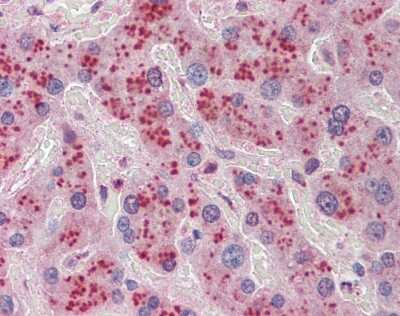 Immunohistochemistry-Paraffin: NDRG2 Antibody [NBP1-55431]