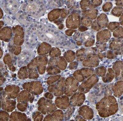 Immunohistochemistry-Paraffin: NDRG2 Antibody [NBP1-81424]