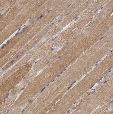 Immunohistochemistry-Paraffin: NDRG2 Antibody [NBP1-81424]