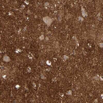 Immunohistochemistry-Paraffin: NDRG2 Antibody [NBP1-81425]
