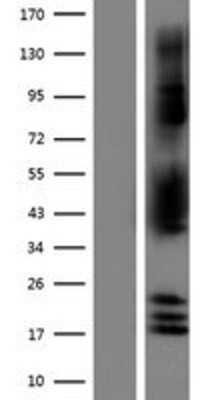 Western Blot: NDRG2 Overexpression Lysate [NBP2-10108]