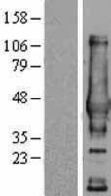 Western Blot: NDRG4 Overexpression Lysate [NBP2-06376]