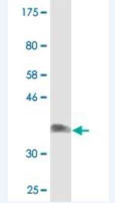Western Blot: NDST3 Antibody (3A9) [H00009348-M02]