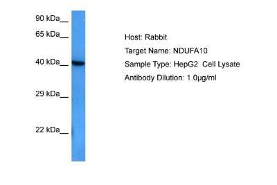 Western Blot: NDUFA10 Antibody [NBP2-87891]
