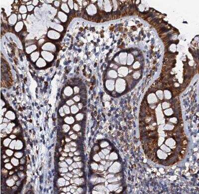 Immunohistochemistry-Paraffin: NDUFA12 Antibody [NBP1-88935]