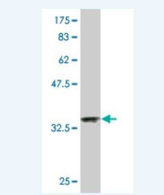 Western Blot: NDUFA2 Antibody (6E7) [H00004695-M01]