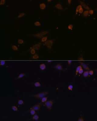 Immunocytochemistry/ Immunofluorescence: NDUFA2 Antibody - BSA Free [NBP2-93743]