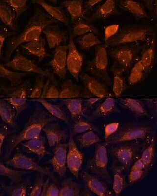 Immunocytochemistry/ Immunofluorescence: NDUFA4L2 Antibody - Azide and BSA Free [NBP2-93831]