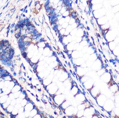 Immunohistochemistry-Paraffin: NDUFA4L2 Antibody - Azide and BSA Free [NBP2-93831]